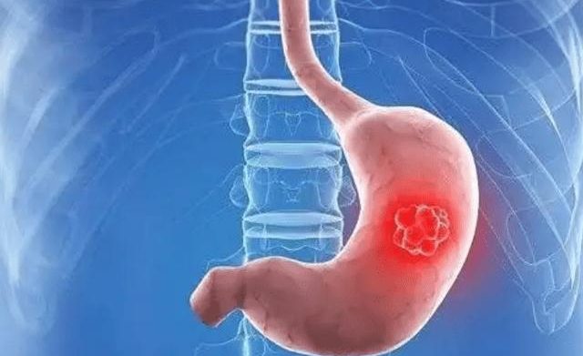 Nano Curcumin Beta Glucan 