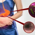 nhung-nguy-hiem-tu-benh-viem-loet-da-day-ta-trang1557369858